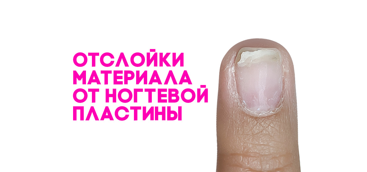 Отслойки материала от ногтевой пластины — статьи на LesNails